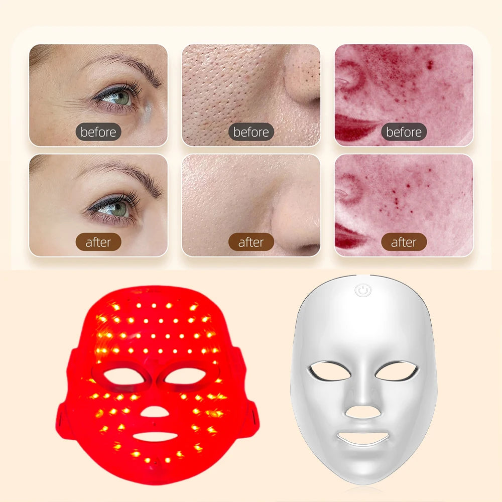 LED Radiance Mask – close-up detail